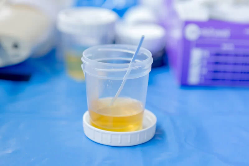 urine-alcohol-test