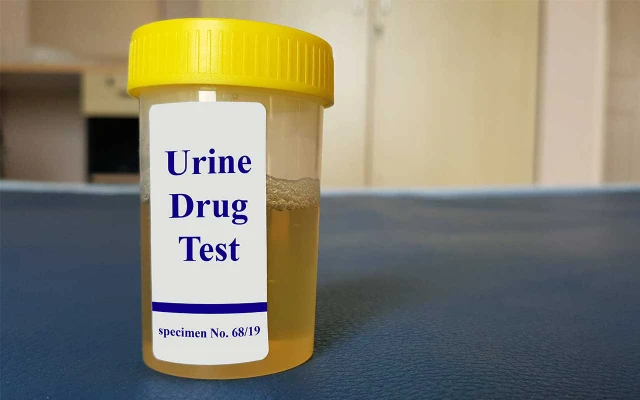 How Long Will Drugs Show in a Urine Test?