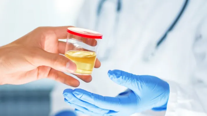 Urine drug tests in Marietta